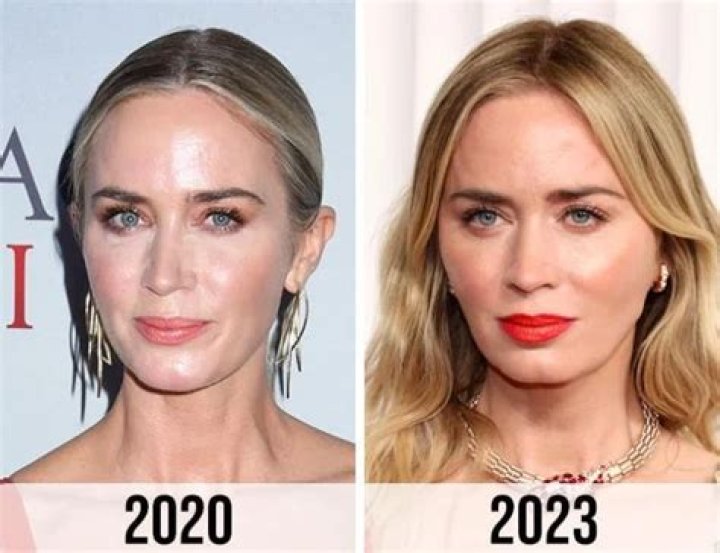 Emily Blunt, Before and After Emily blunt, Beautiful actresses, Blunt