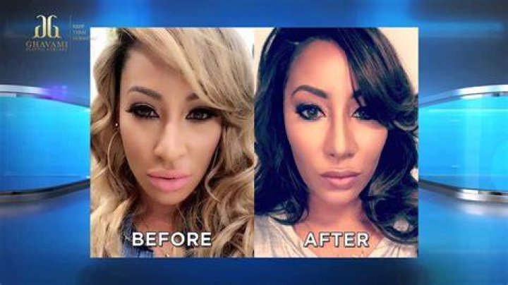 Hazel E Before And After Nose Job / Hazel E From Love And Hip Hop Is