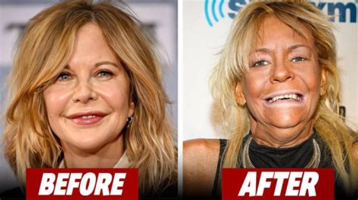 HazelE Plastic Surgery