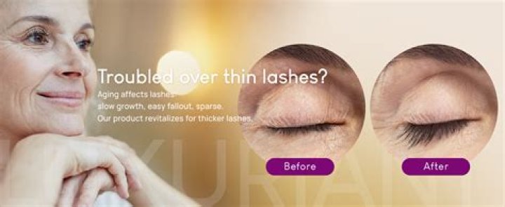lash enhancement serum benefits