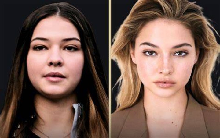 Madelyn Cline Before And After Plastic Surgery Health And Age