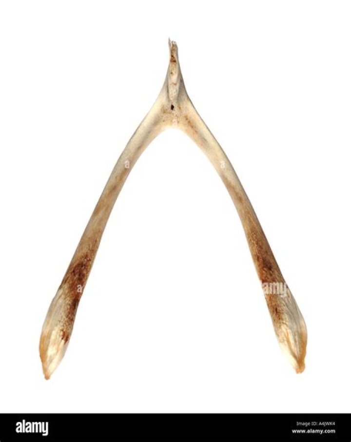 Wish Bone's Philanthropy