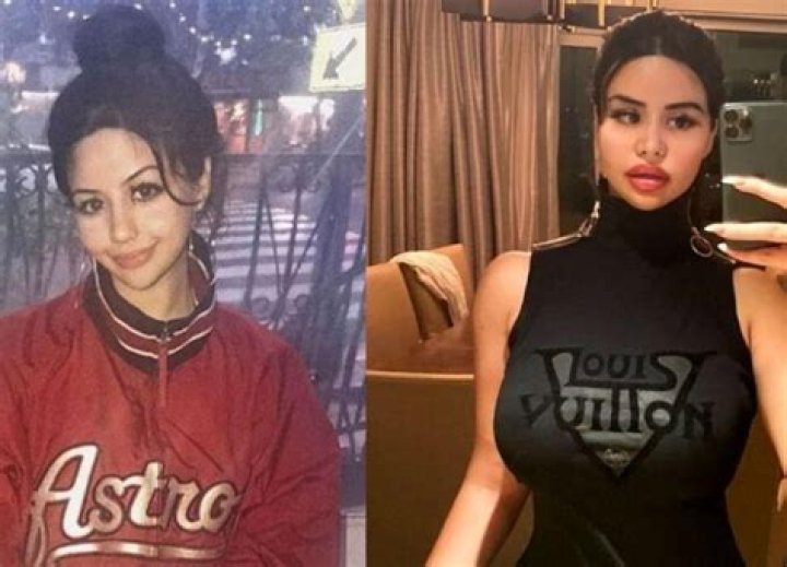 Yungsweetro Before Plastic Surgery Rojean Kar Looks Eerily Similar to